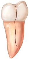 Split Tooth Split Tooth