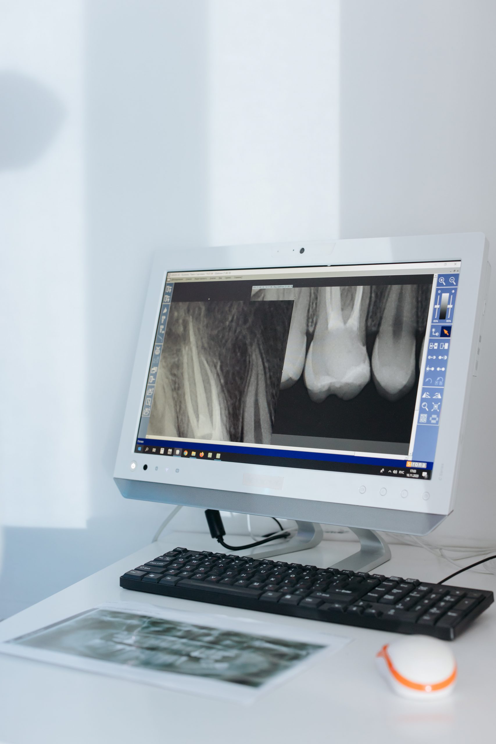 Root Canals The myths and the truth (hint they are not terrible
